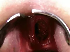 Succi عکس های سکسی سایت شهوانی لزبین کاکس لیس
